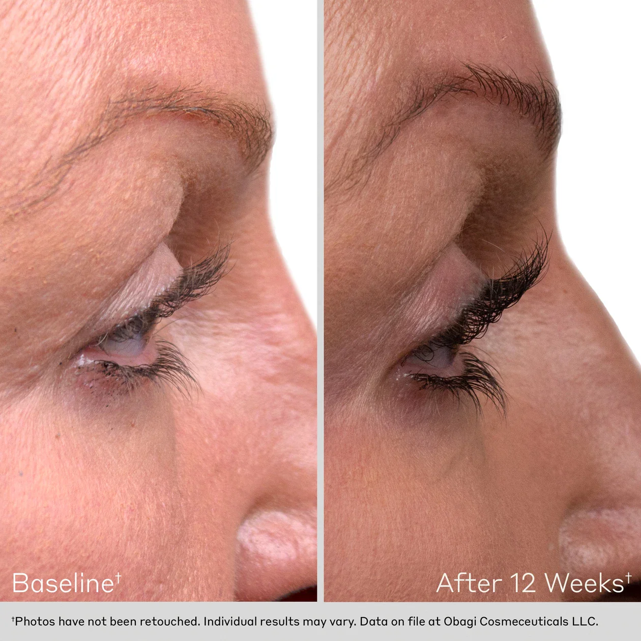 OBAGI Eyelash Enhancing Serum — Refresh Skin + Shop